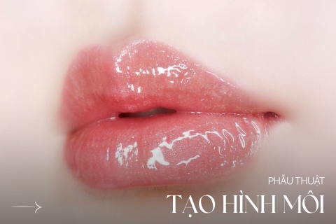 Phẫu thuật tạo hình môi